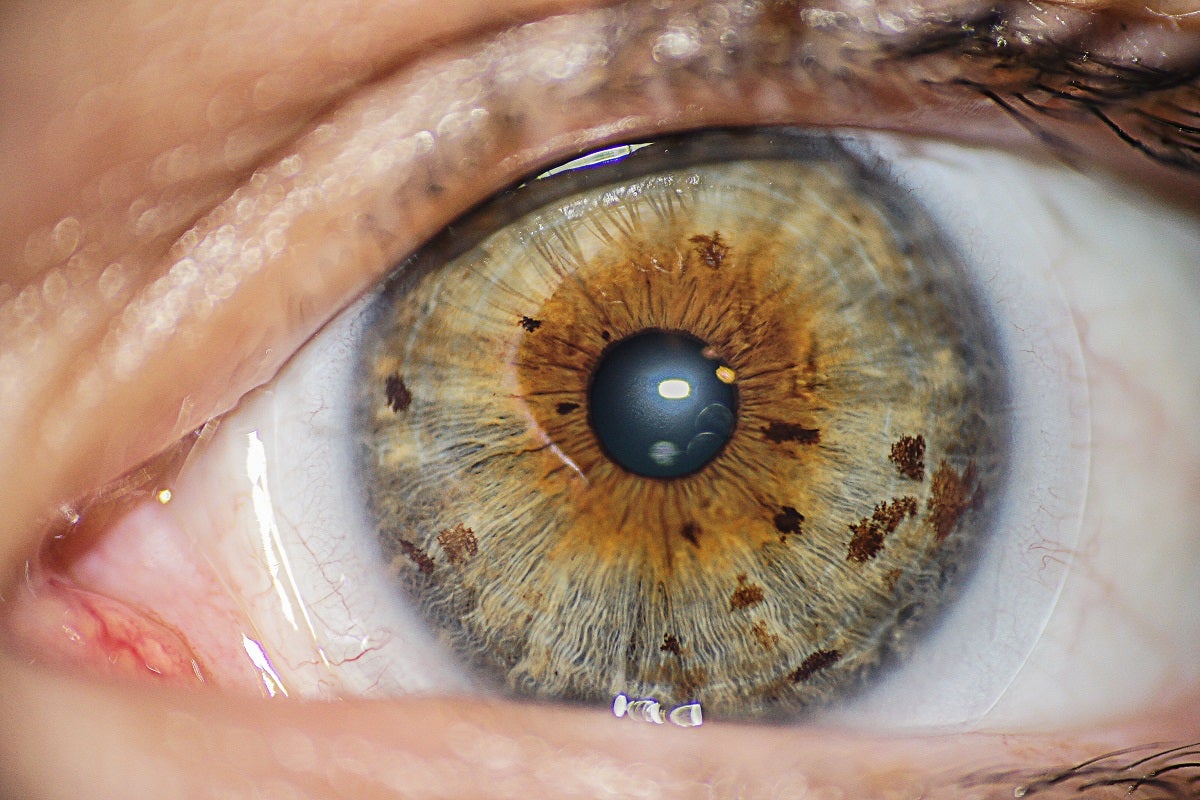 Gold Particles May Help Restore Vision by Mimicking Photoreceptors Gold Particles May Help Restore Vision by Mimicking Photoreceptors