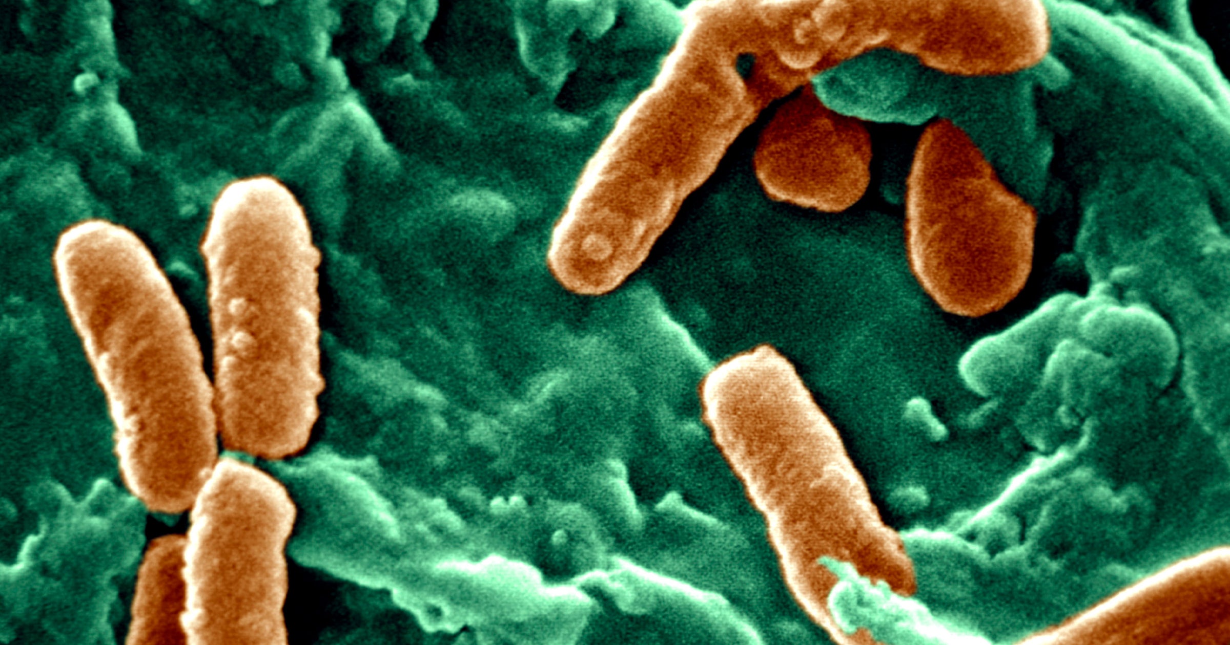 Scientists Identify Plastic-Feeding Superbug Spreading Through Hospitals