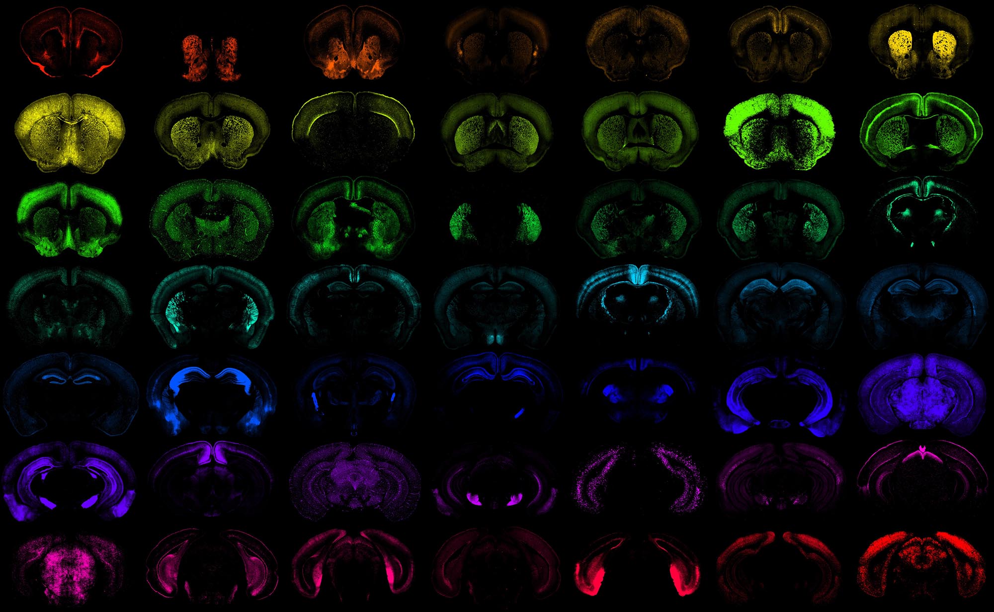 NIH-Funded Study Uncovers Breakthrough for Targeted Neurological Therapies