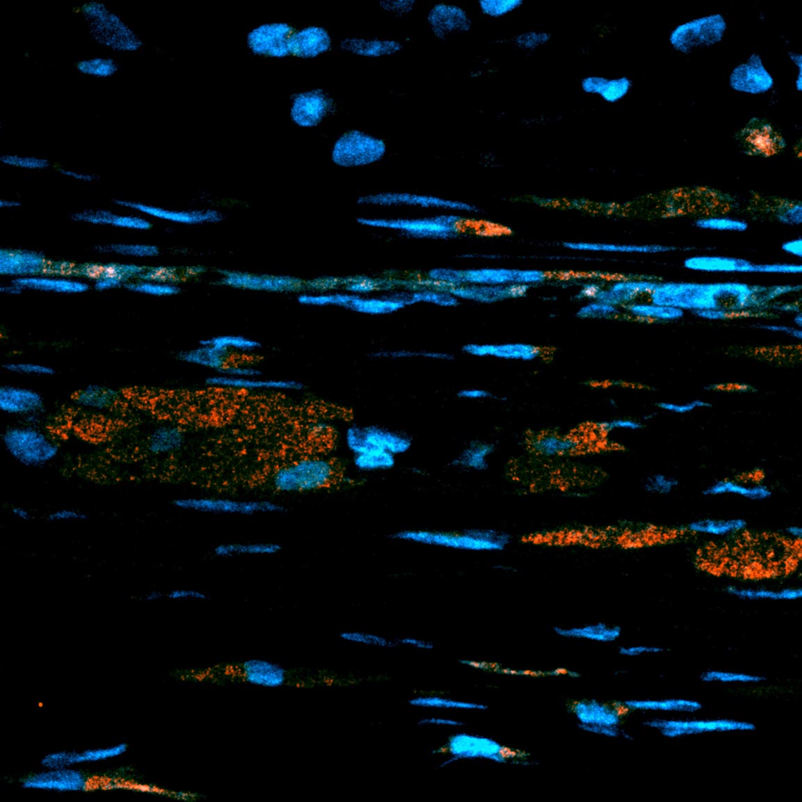 New Technique Could Boost Potency of Cell Therapies, NIH Researchers Say New Technique Could Boost Potency of Cell Therapies, NIH Researchers Say