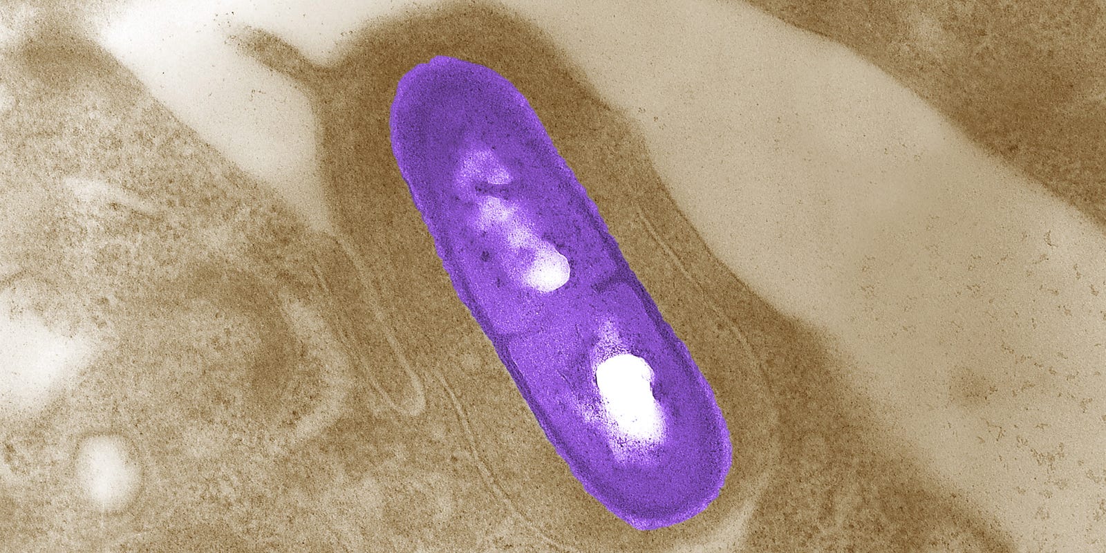 Prepared Foods Linked to Listeria Outbreak in Four States, 10 Hospitalized Prepared Foods Linked to Listeria Outbreak in Four States, 10 Hospitalized