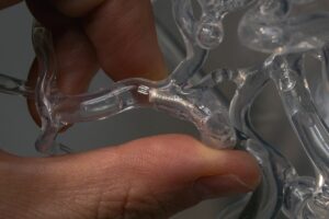 Innovative ‘Spinning’ Device Offers New Hope for Stroke Patients