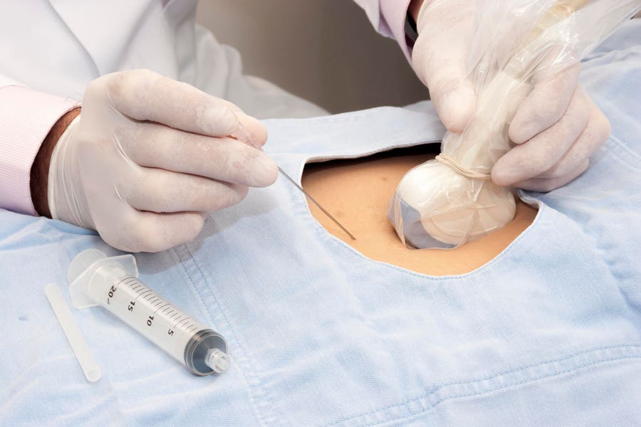 Image-Guided Needle Procedures: A Cornerstone of Modern Healthcare
